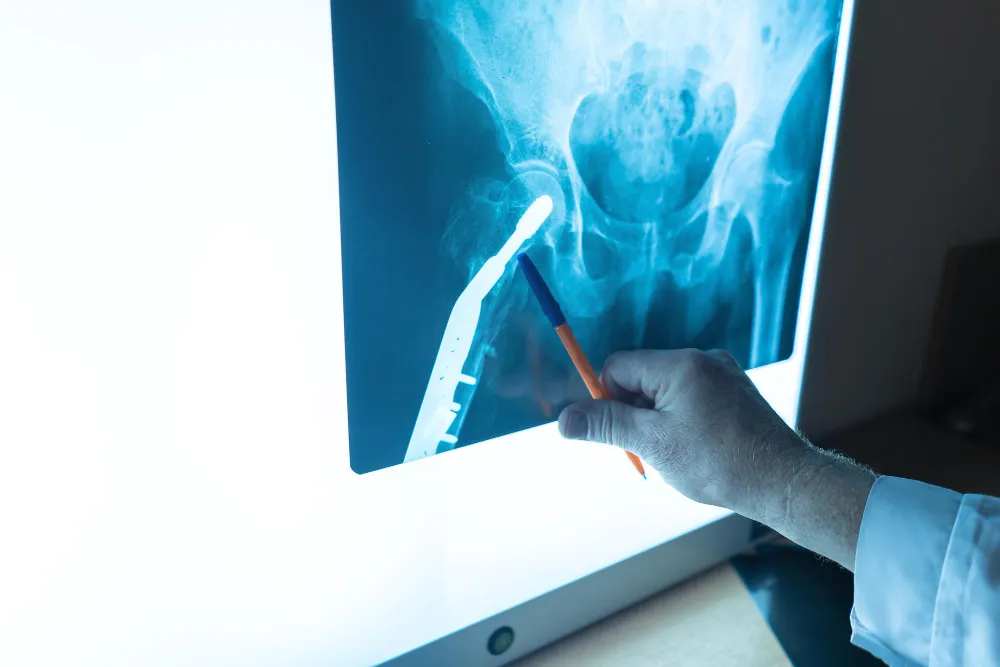 digital x-ray